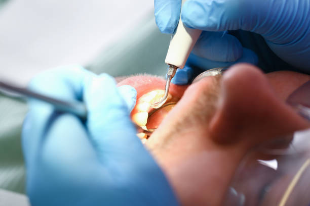 Best Mobile Emergency Dentist in Washington, IA